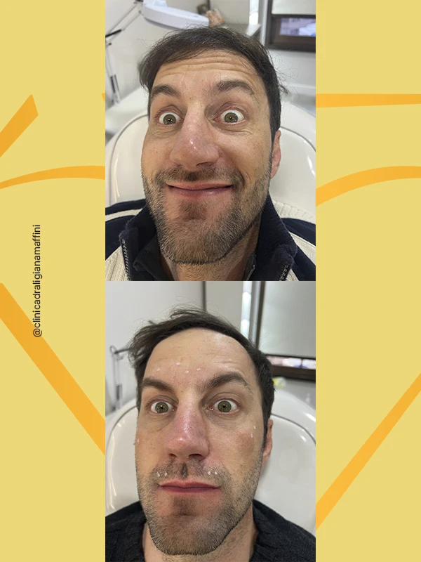 Tratamento 2